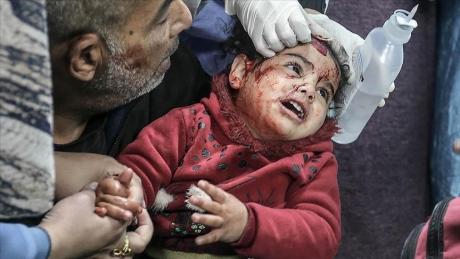 ООН: почти 100 тысяч человек Газы убиты, ранены или пропали без вести за 4 месяца войны 