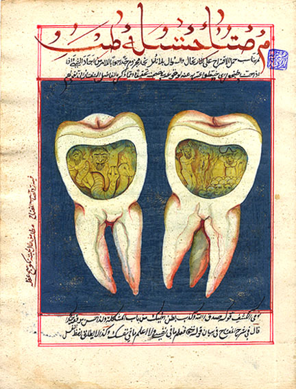 Слева: первая страница рукописи аль-Аккирмани об использовании сивака, XVIII в. Справа: Рисунок из османской книги XVIII в. о стоматологии